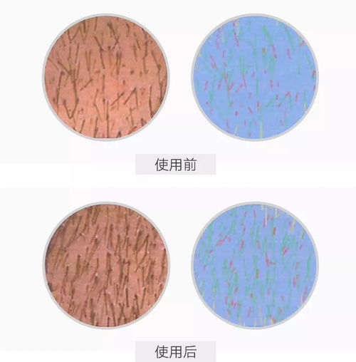 楊冪發(fā)際線變低還長(zhǎng)出許多小絨毛,真的去植發(fā)了